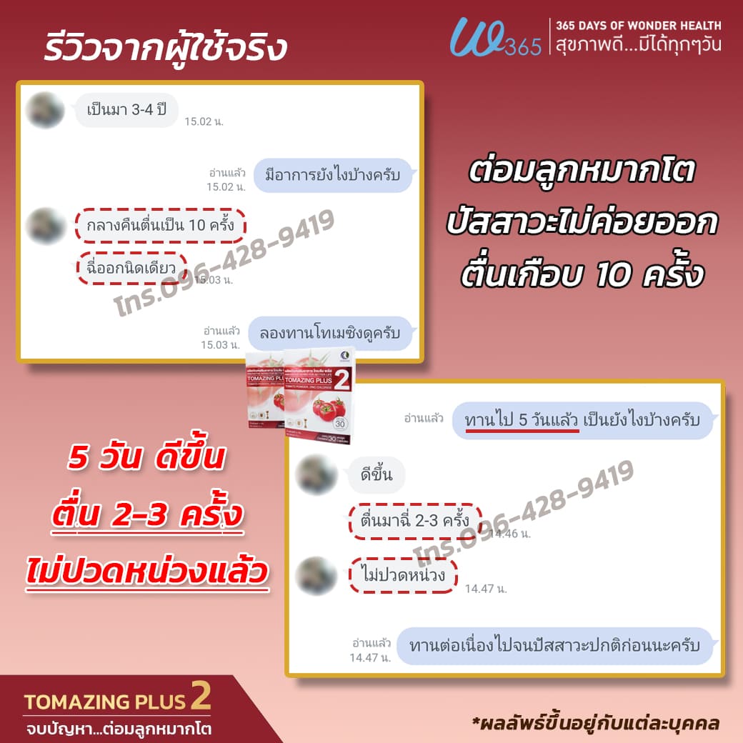 Tomazing_โทเมซิง_ต่อมลูกหมากโต_Review01